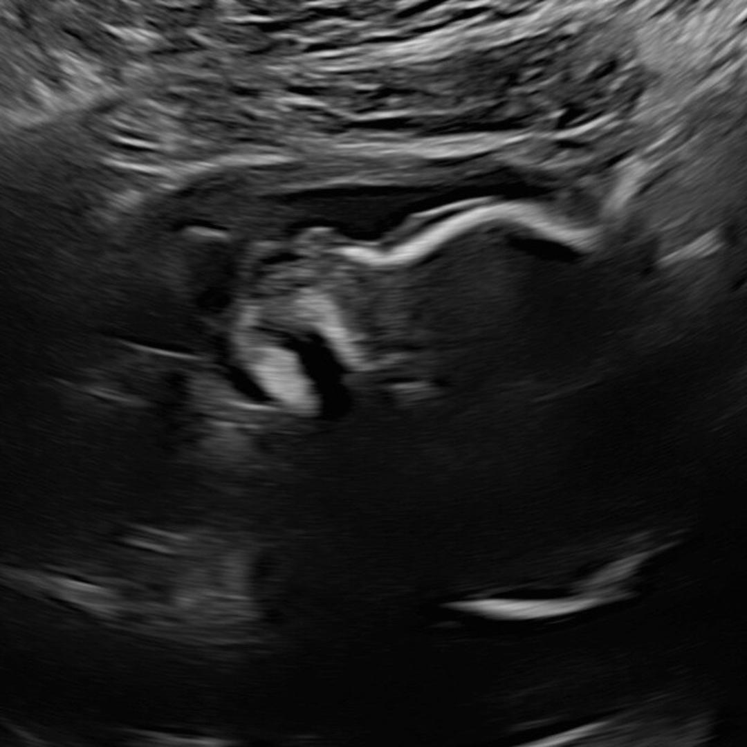 Photo shared by Emily for their Babylist baby registry.