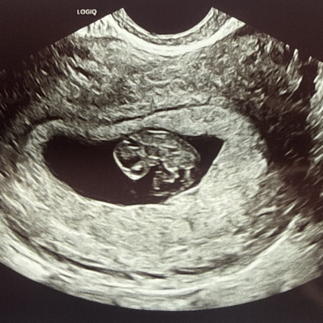 Photo shared by Sarah for their Babylist baby registry.
