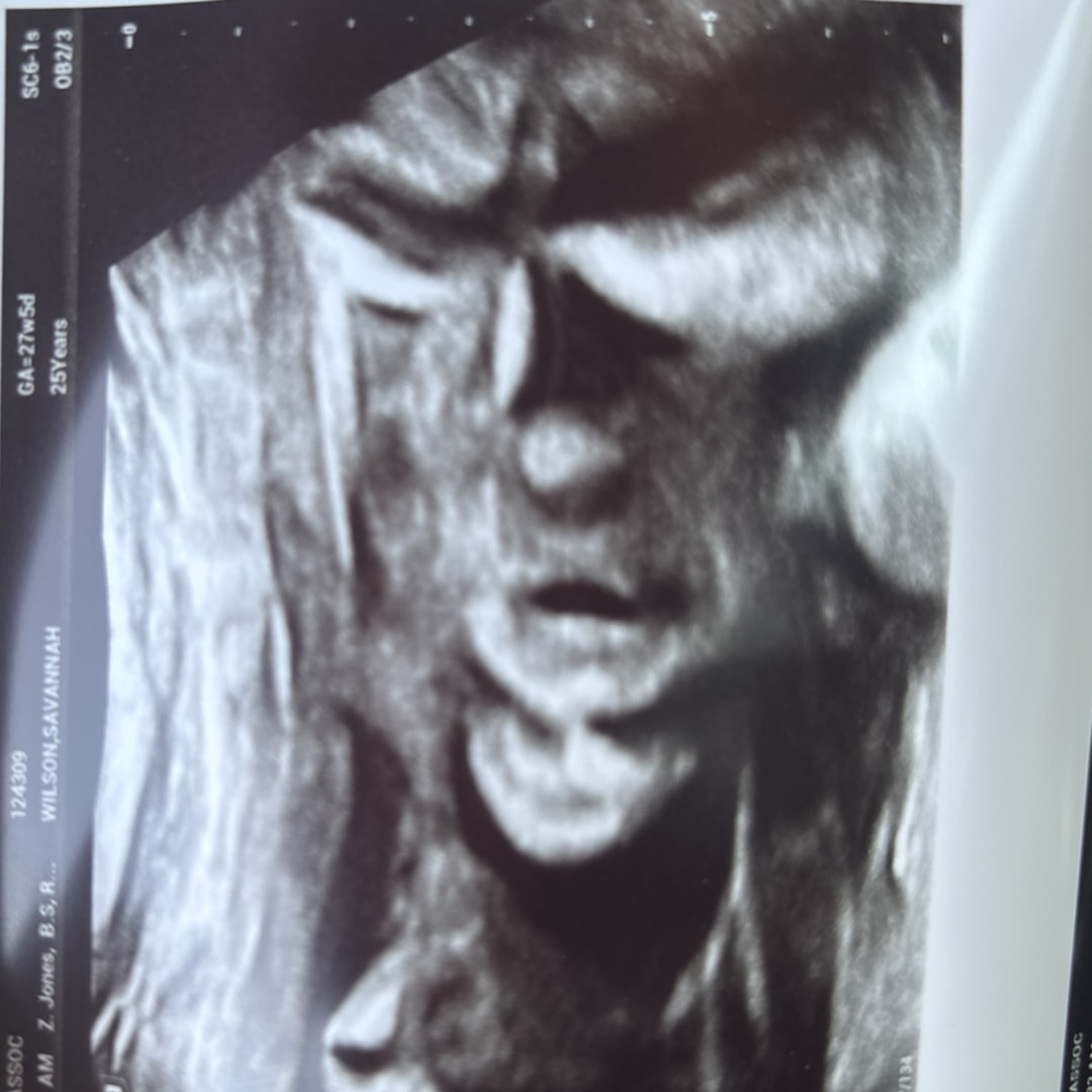 Photo shared by Savannah for their Babylist baby registry.