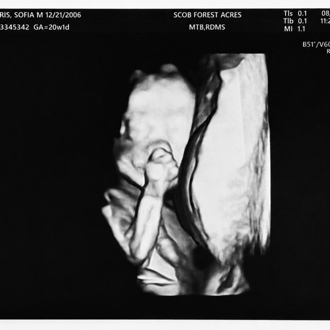 Photo shared by Sofia for their Babylist baby registry.