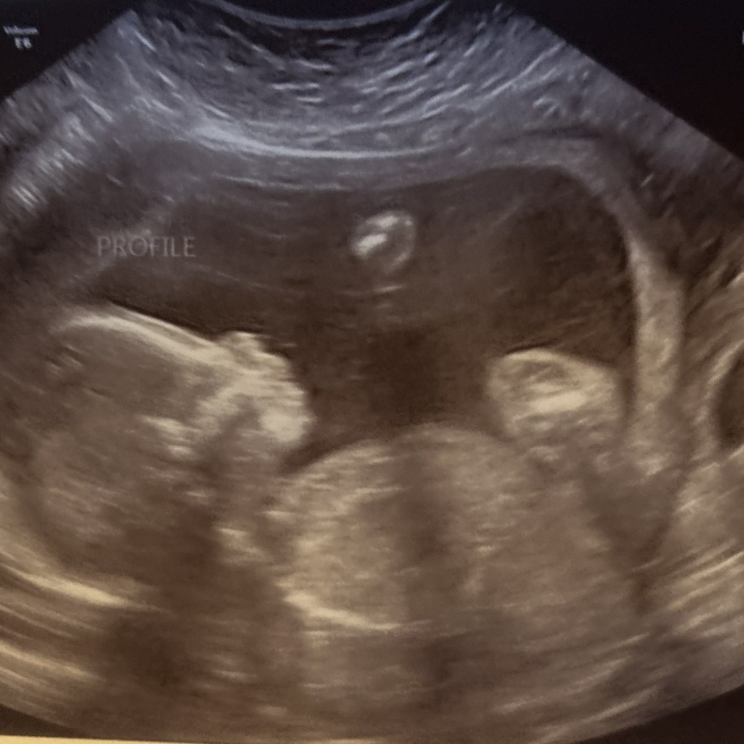 Photo shared by Victoria for their Babylist baby registry.