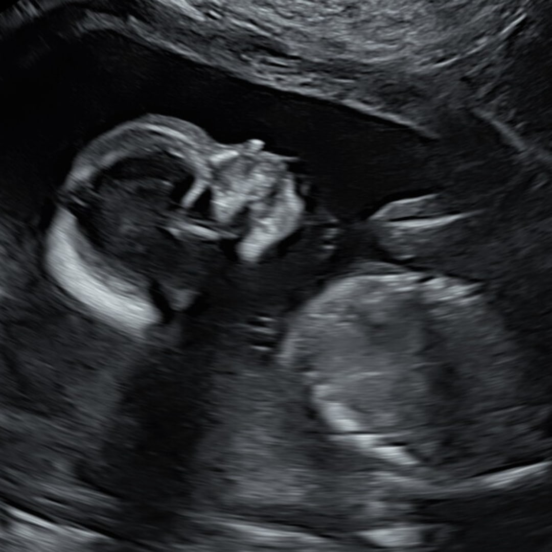 Photo shared by Madason for their Babylist baby registry.