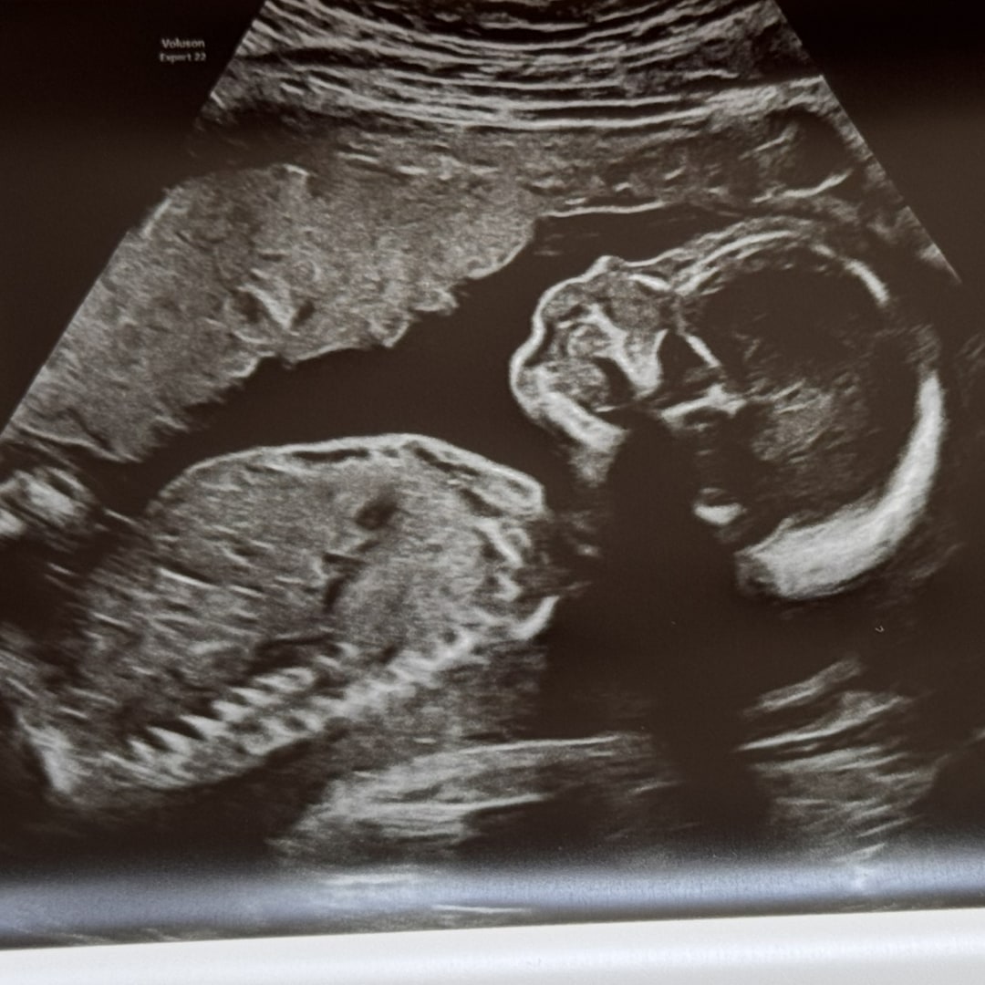 Photo shared by Jamie for their Babylist baby registry.