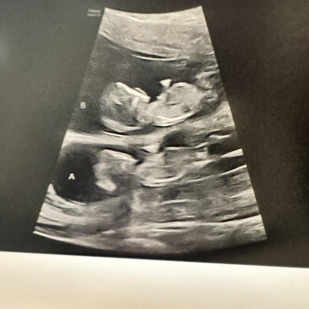 Photo shared by Jessica for their Babylist baby registry.