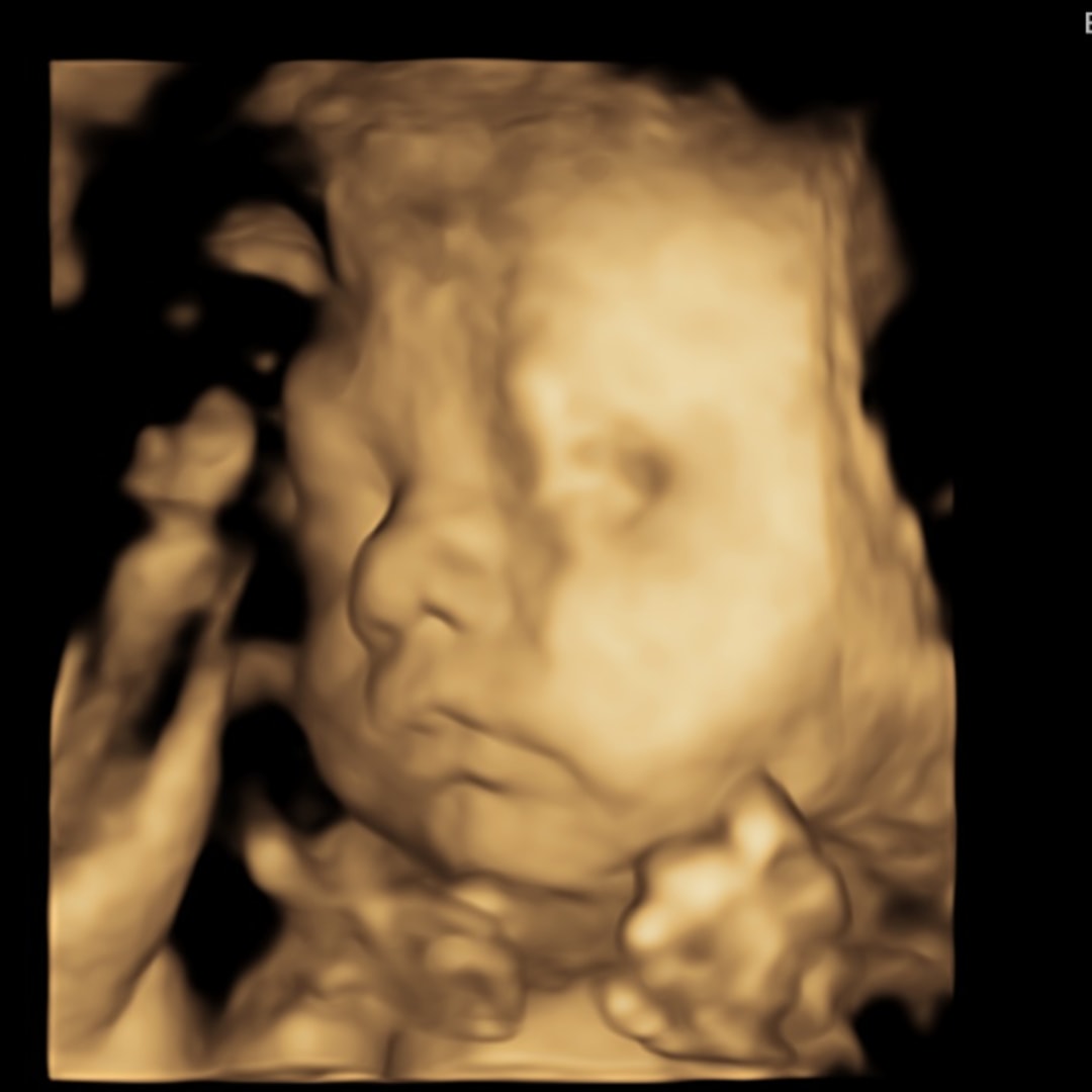 Photo shared by Adrienne for their Babylist baby registry.