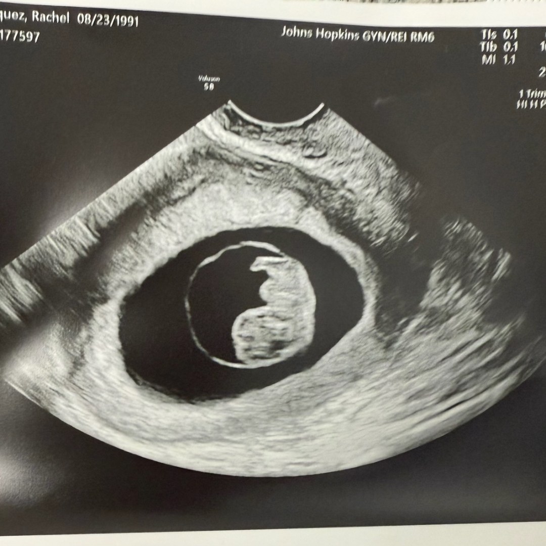 Photo shared by Rachel for their Babylist baby registry.