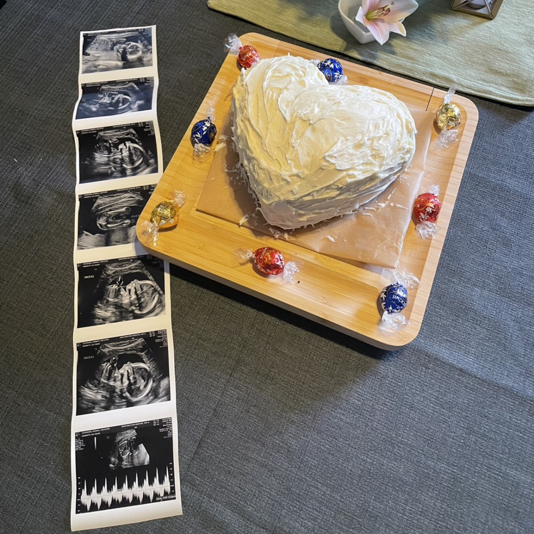 Photo shared by Hannah and Caleb for their Babylist baby registry.