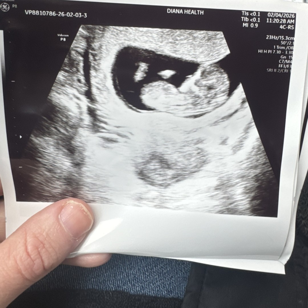 Photo shared by Emily for their Babylist baby registry.