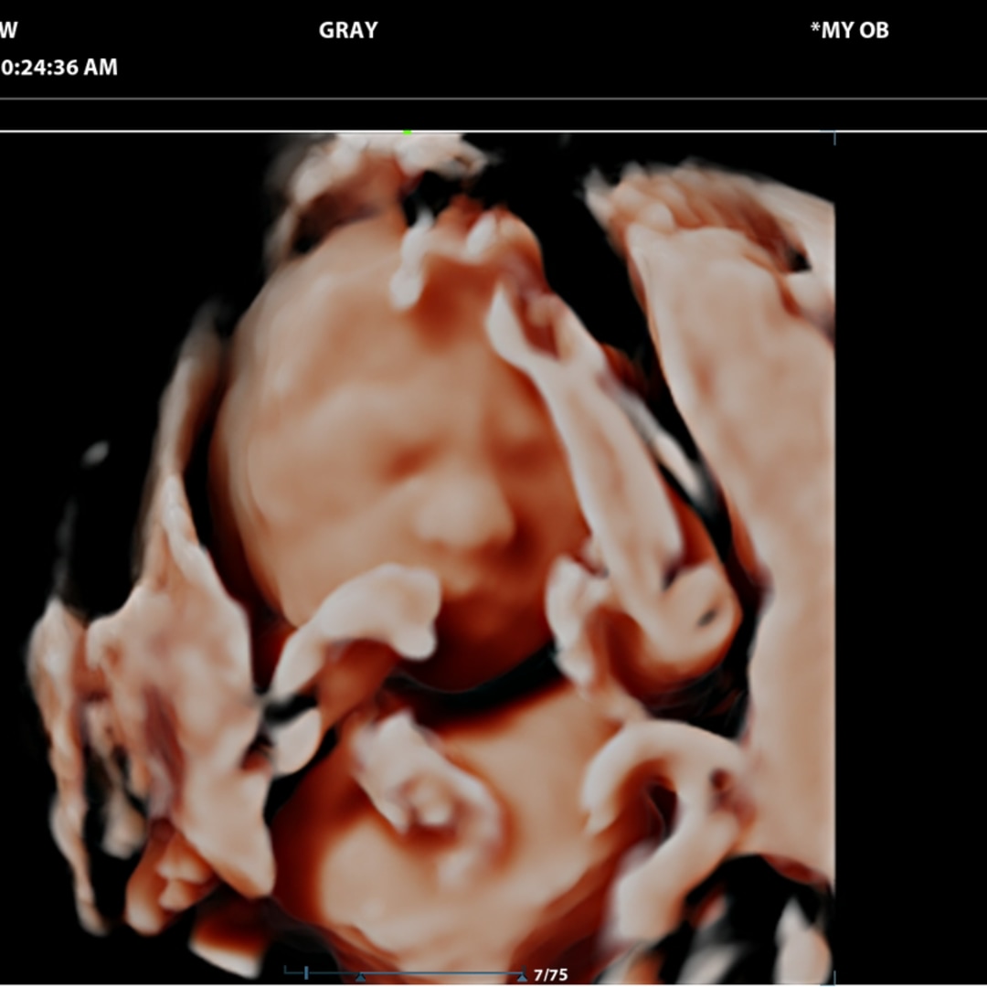 Photo shared by Kassidy for their Babylist baby registry.