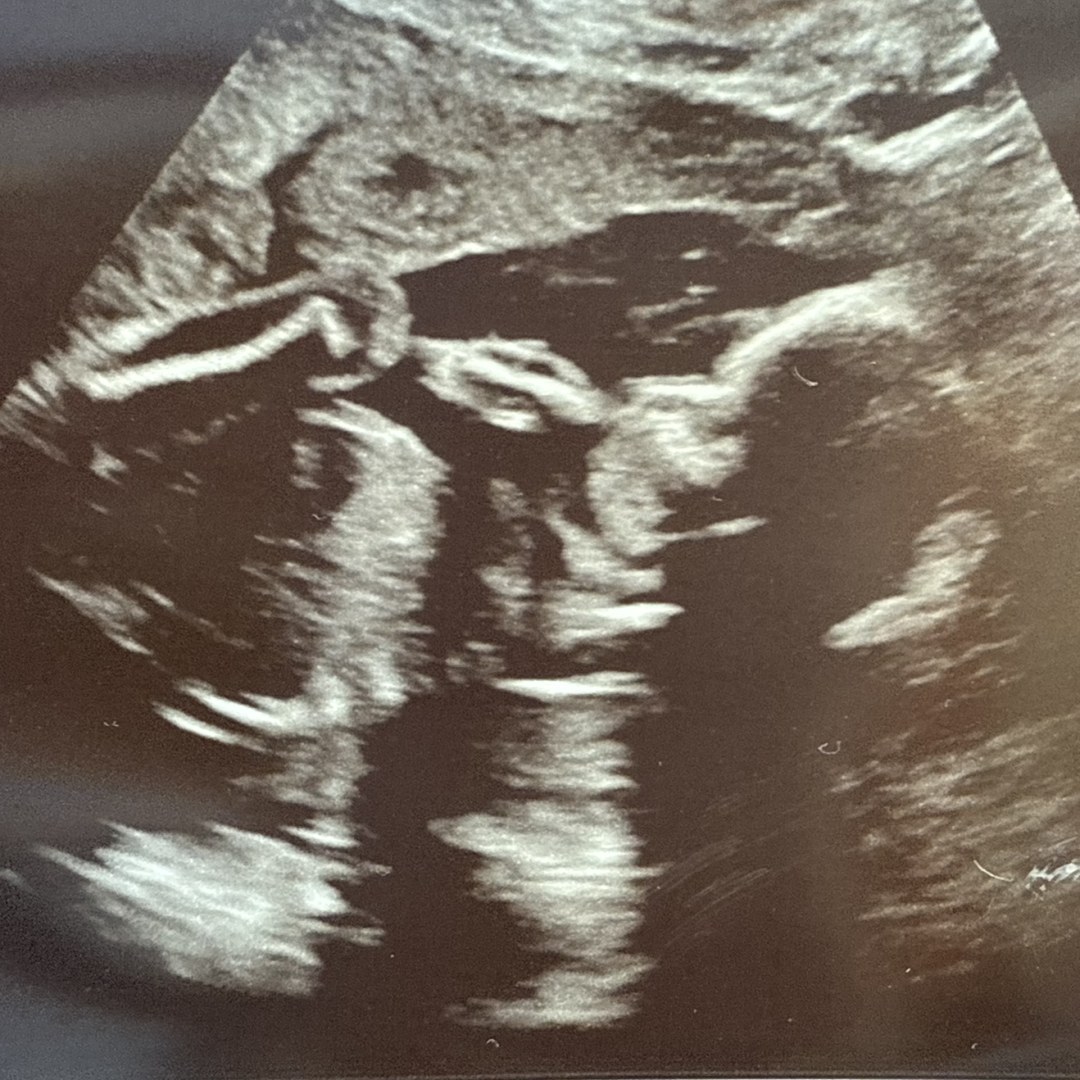 Photo shared by Stephanie for their Babylist baby registry.