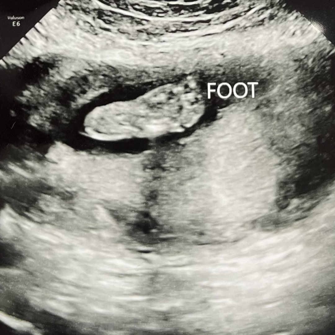 Photo shared by Amy for their Babylist baby registry.