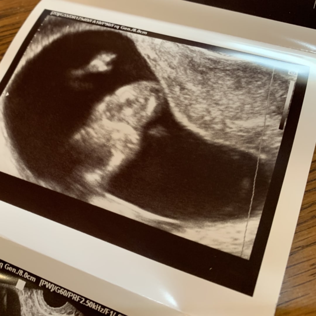 Photo shared by Chloe for their Babylist baby registry.