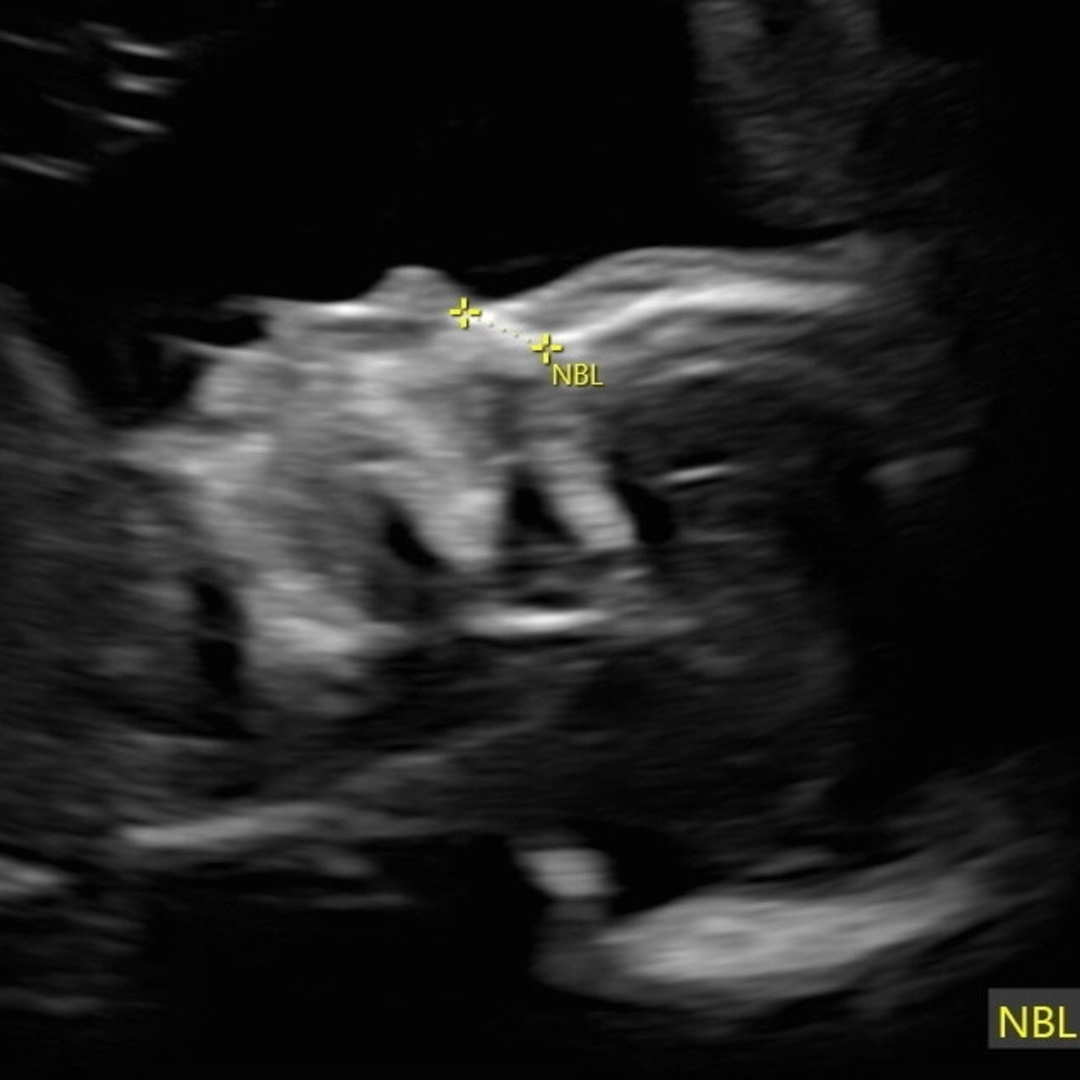 Photo shared by Evelyn for their Babylist baby registry.