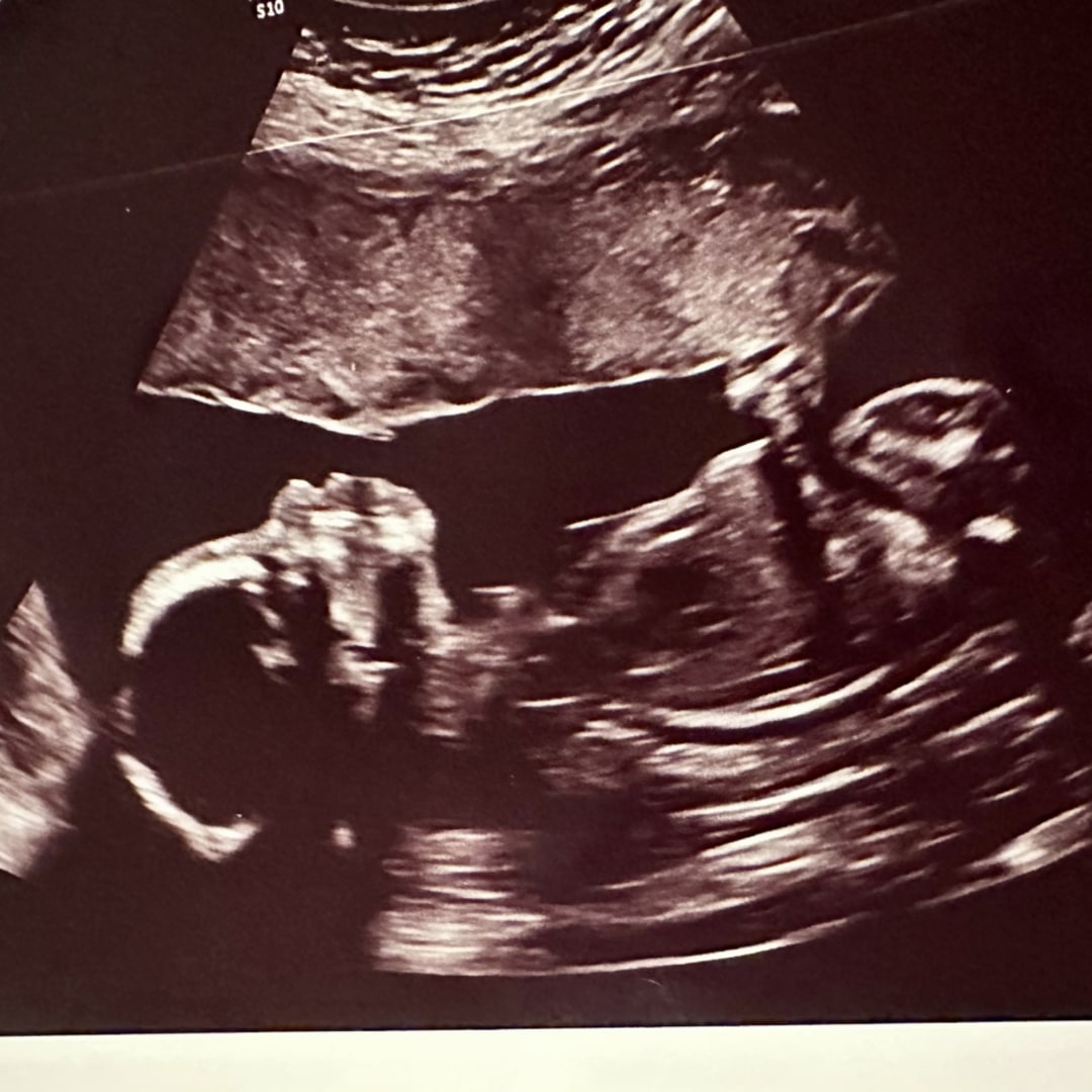 Photo shared by Colleen for their Babylist baby registry.