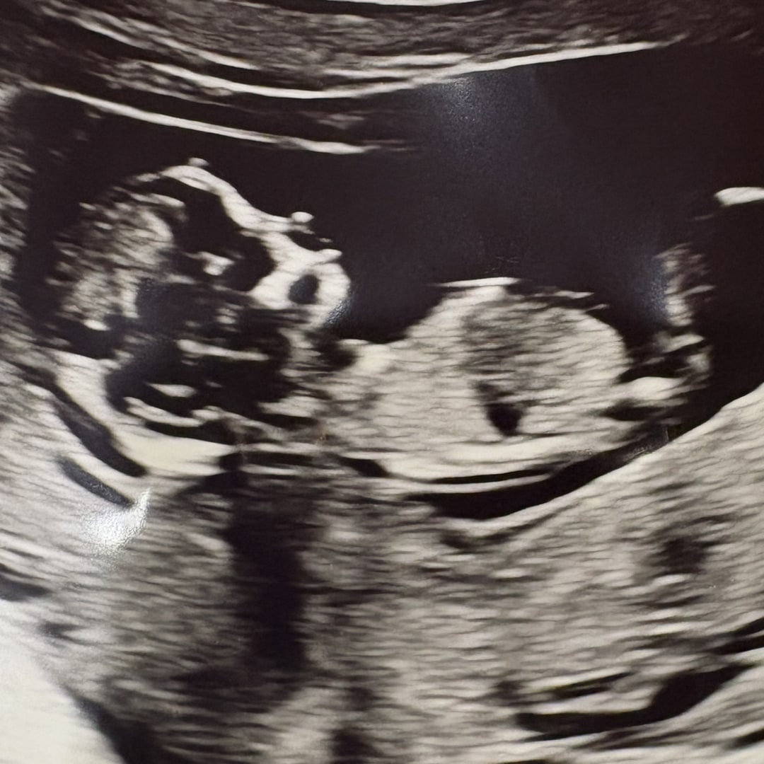 Photo shared by Gabby for their Babylist baby registry.