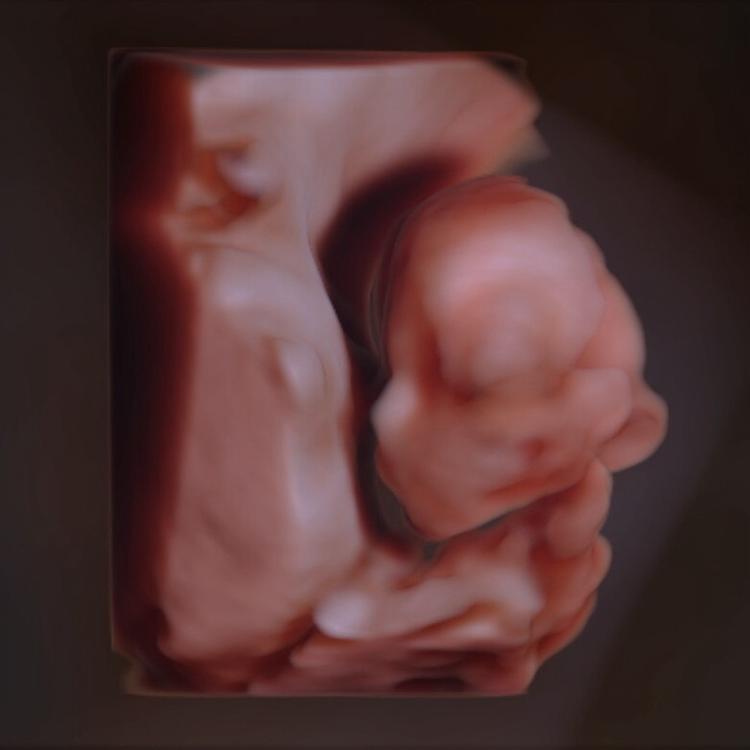 Photo shared by Kanani for their Babylist baby registry.