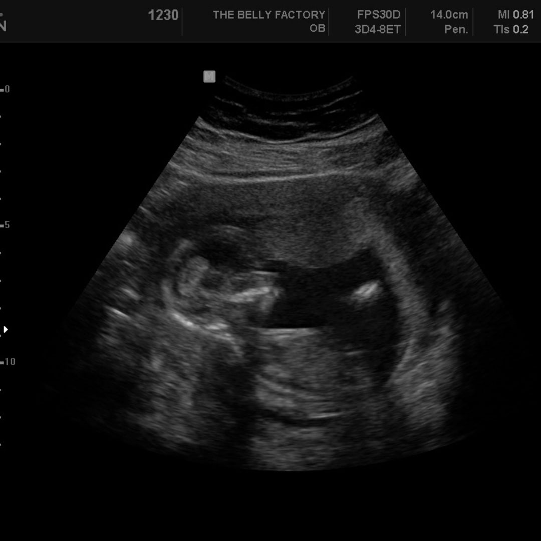 Photo shared by Kassidy for their Babylist baby registry.