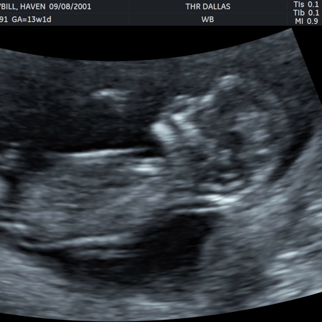 Photo shared by Haven for their Babylist baby registry.