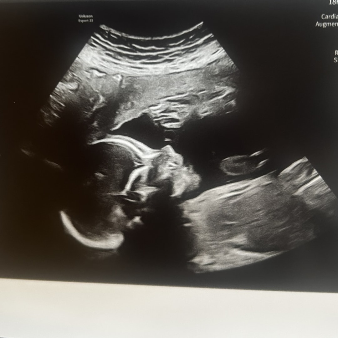 Photo shared by Brianna for their Babylist baby registry.