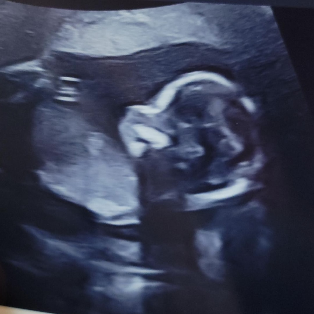Photo shared by Jacquelynn for their Babylist baby registry.