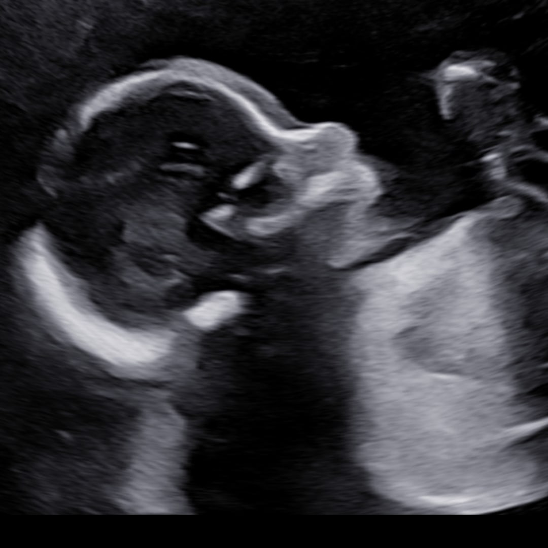 Photo shared by Taylor for their Babylist baby registry.