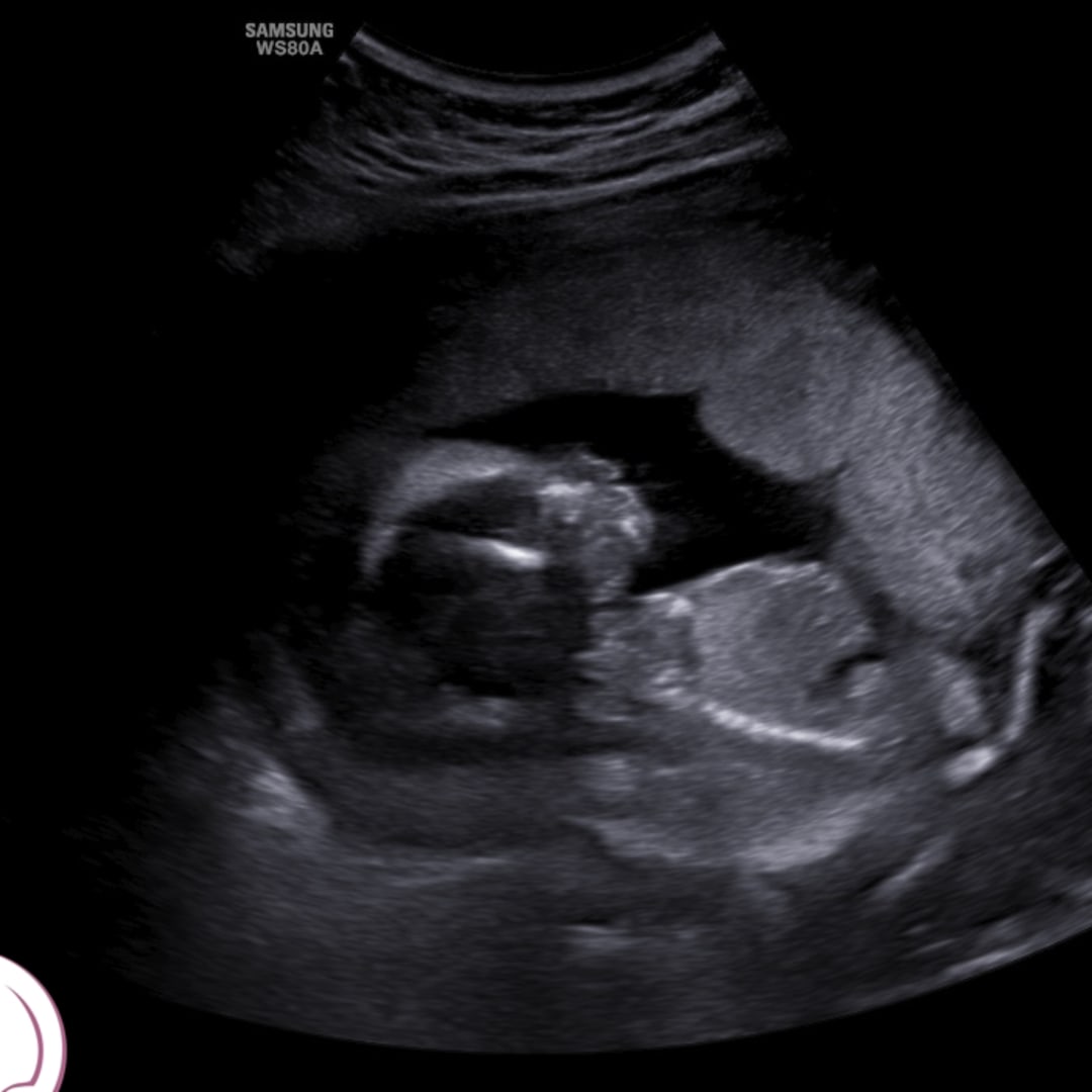 Photo shared by Jazzelle for their Babylist baby registry.