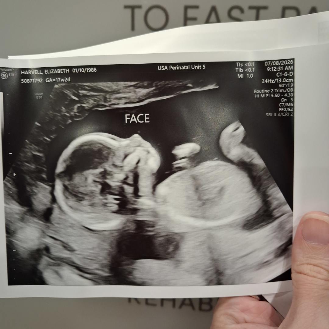 Photo shared by Elizabeth for their Babylist baby registry.