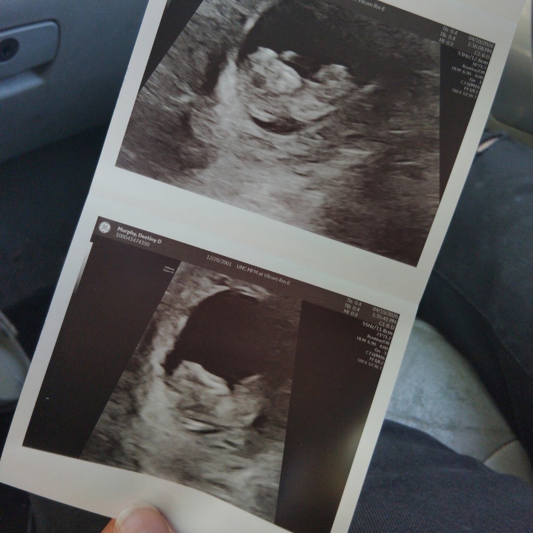 Photo shared by Kaze for their Babylist baby registry.