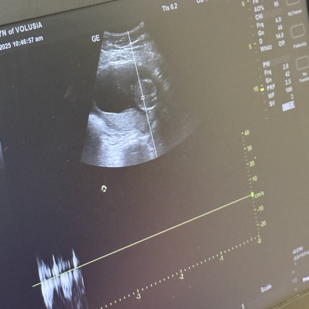 Photo shared by Sierra for their Babylist baby registry.