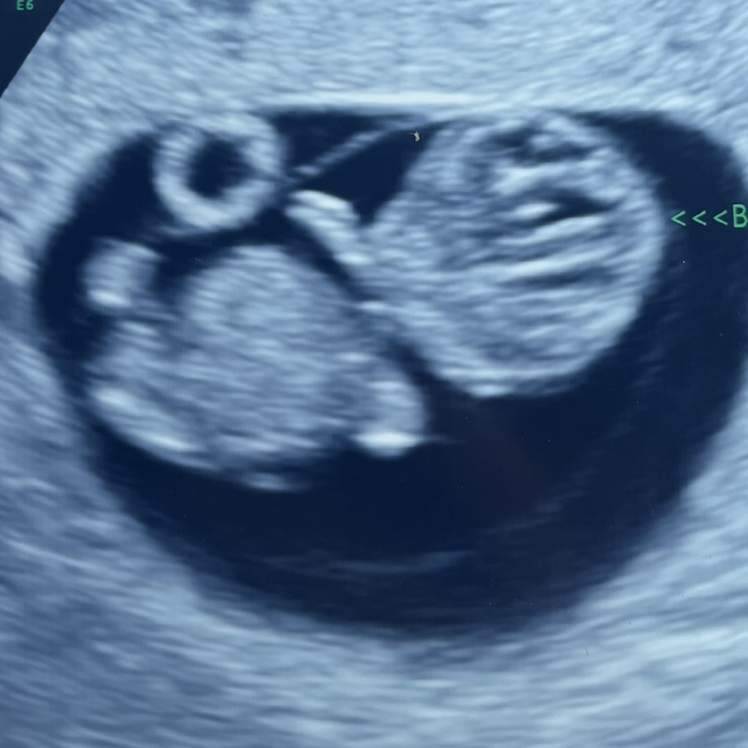 Photo shared by Ashlyn for their Babylist baby registry.