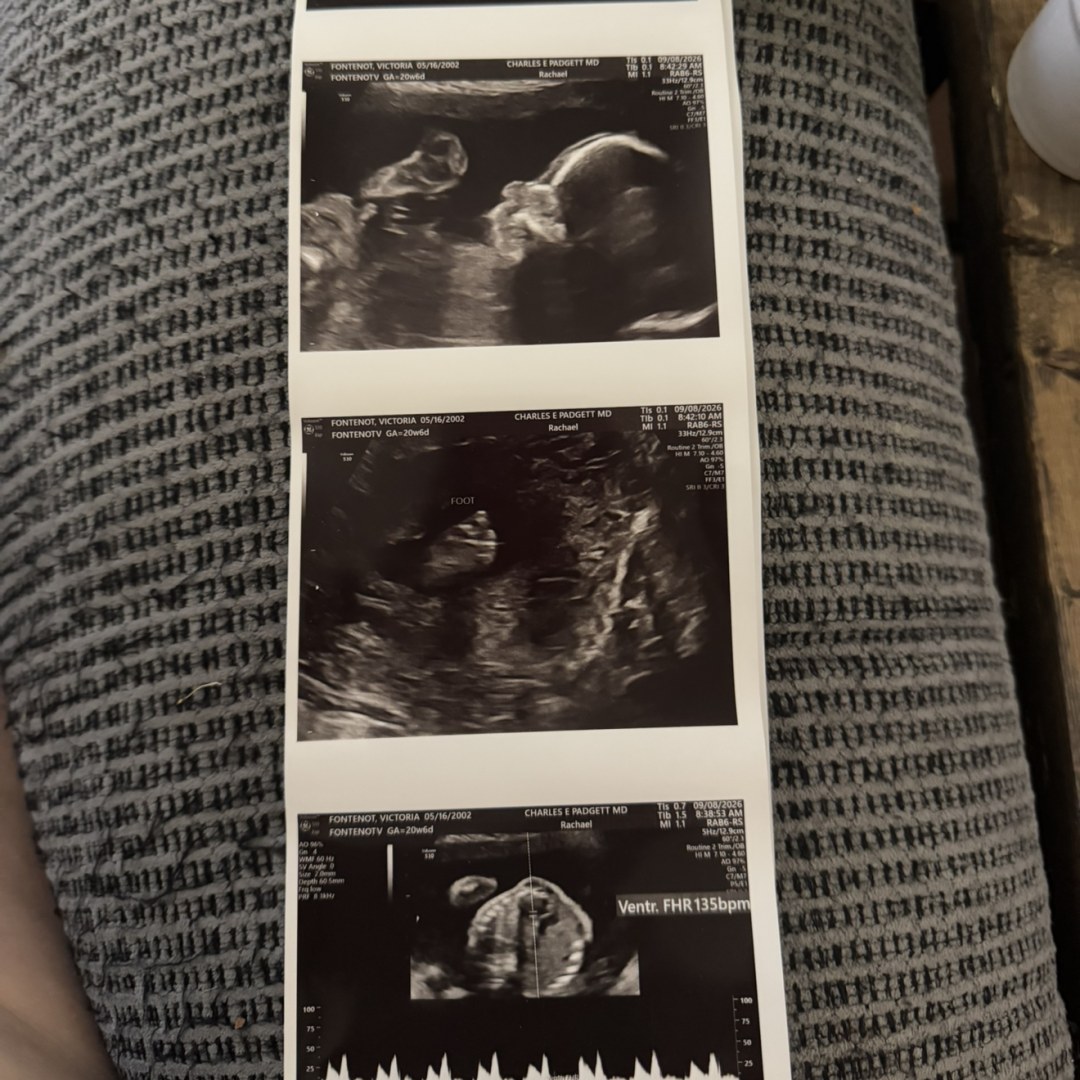 Photo shared by Victoria for their Babylist baby registry.