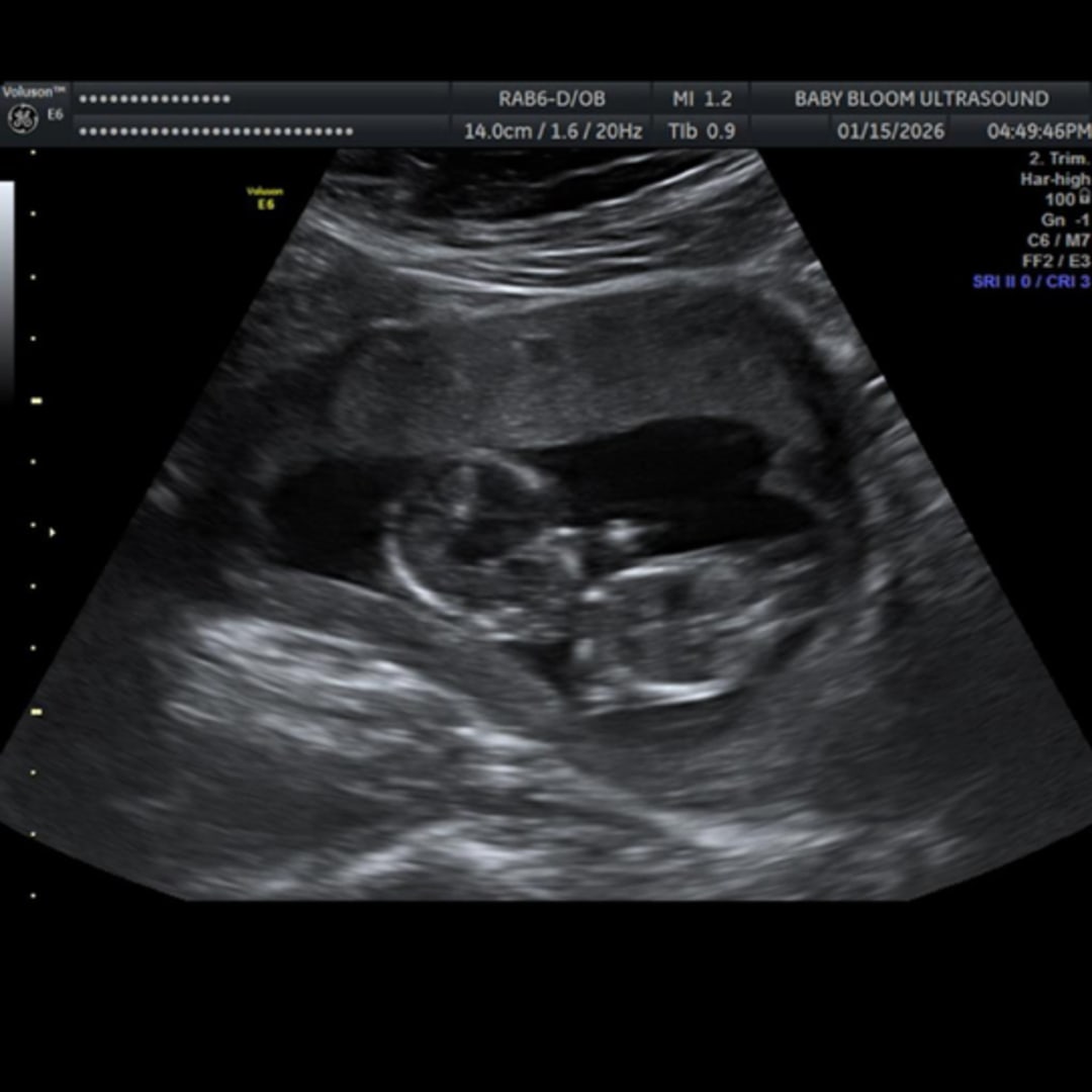 Photo shared by Genesis for their Babylist baby registry.