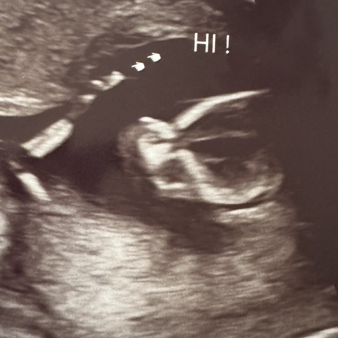 Photo shared by Samantha for their Babylist baby registry.