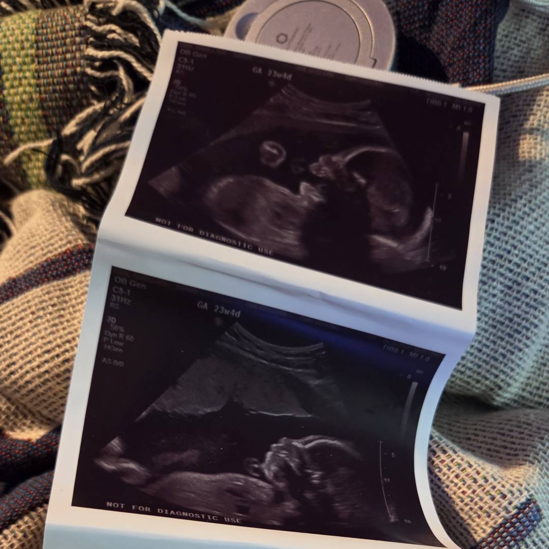 Photo shared by Pamela for their Babylist baby registry.