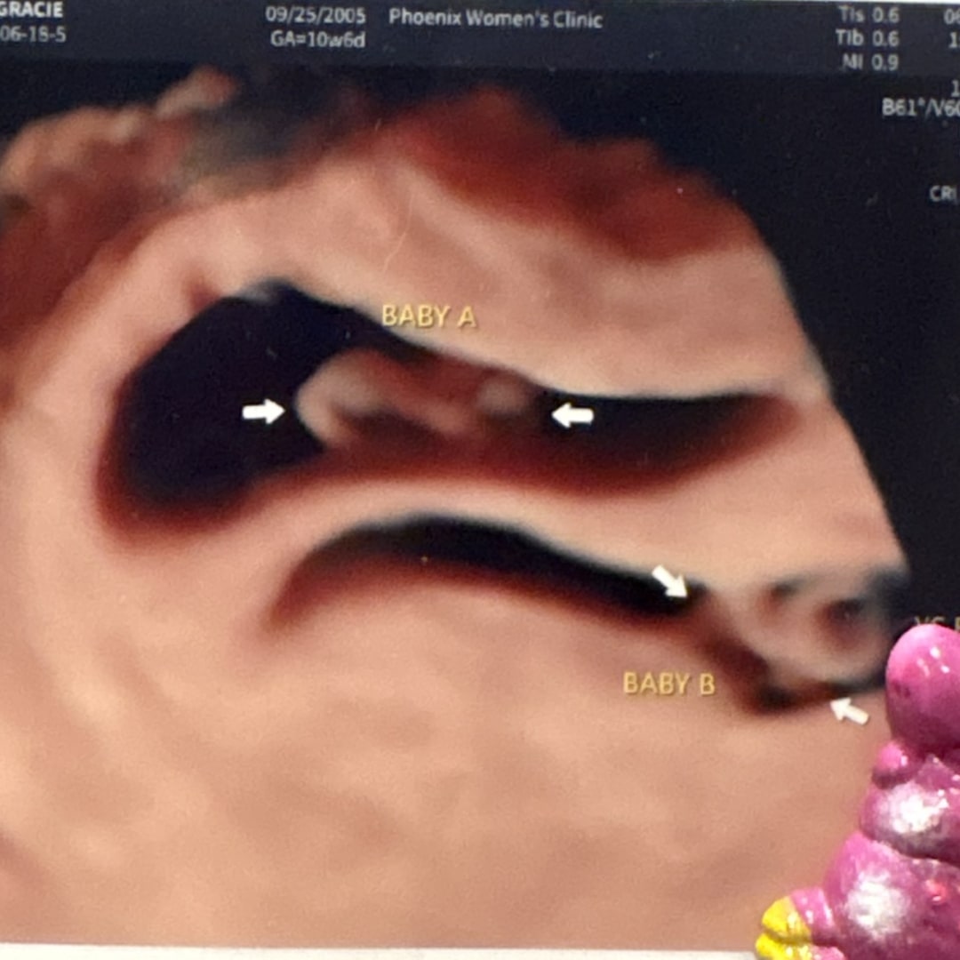 Photo shared by Gracie for their Babylist baby registry.