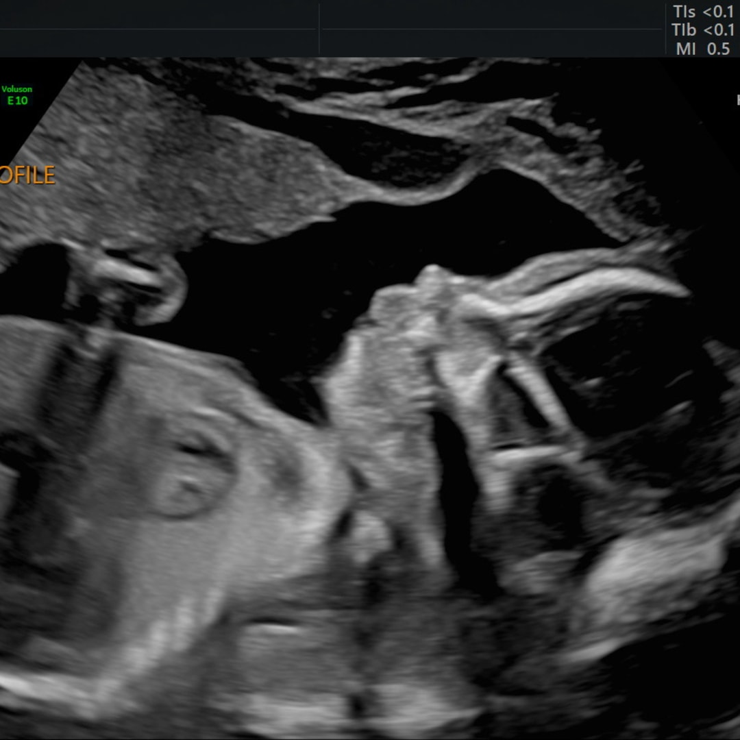 Photo shared by Chelsea for their Babylist baby registry.