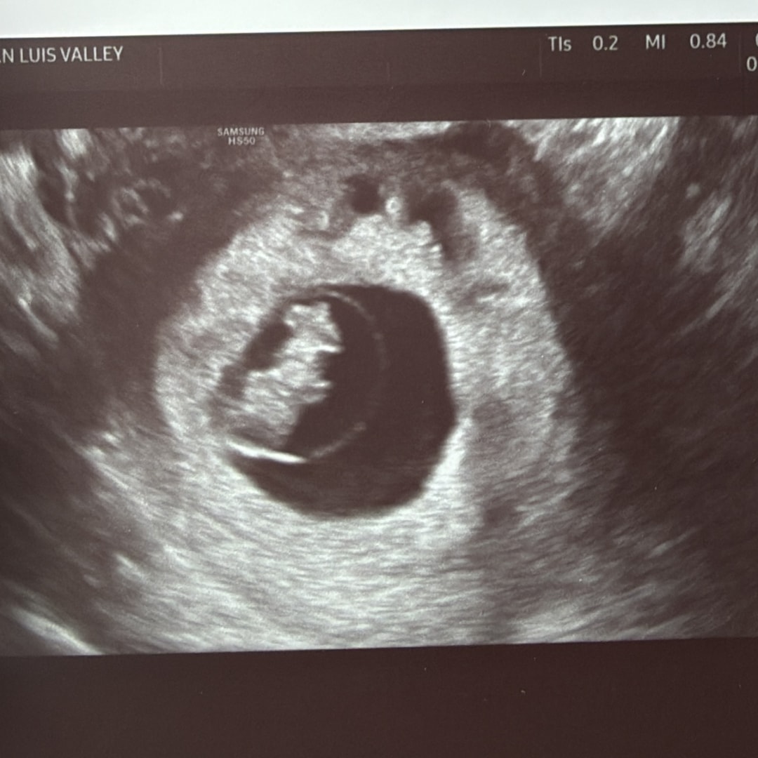 Photo shared by Athena for their Babylist baby registry.