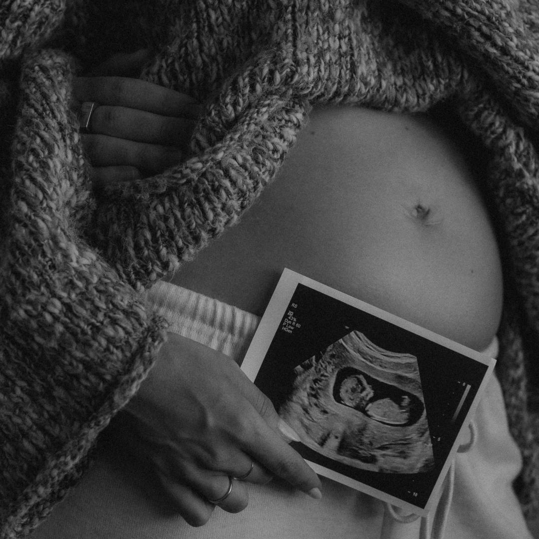 Photo shared by Remington for their Babylist baby registry.