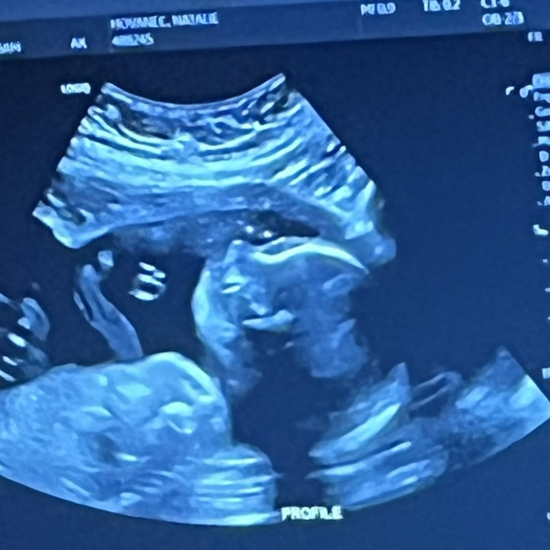 Photo shared by Natalie for their Babylist baby registry.