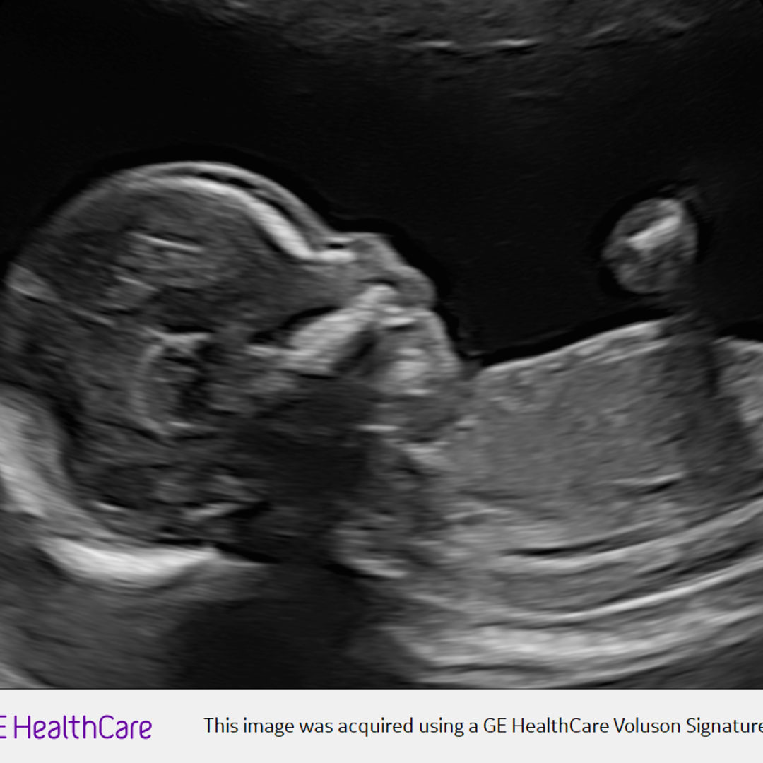 Photo shared by Samantha for their Babylist baby registry.