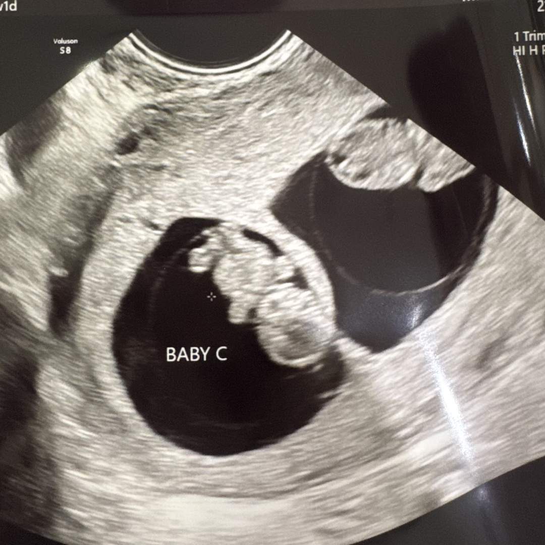 Photo shared by Karly for their Babylist baby registry.