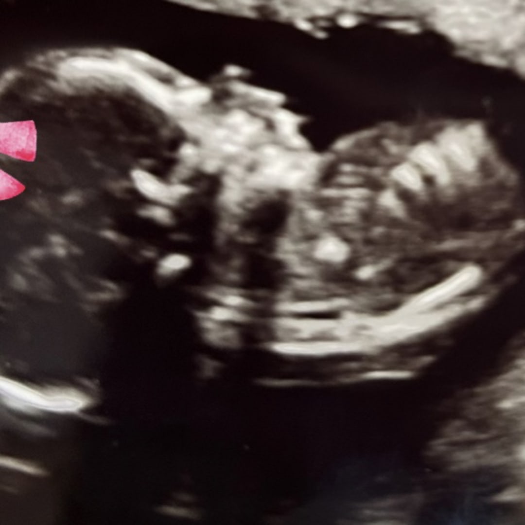 Photo shared by Ashlea for their Babylist baby registry.