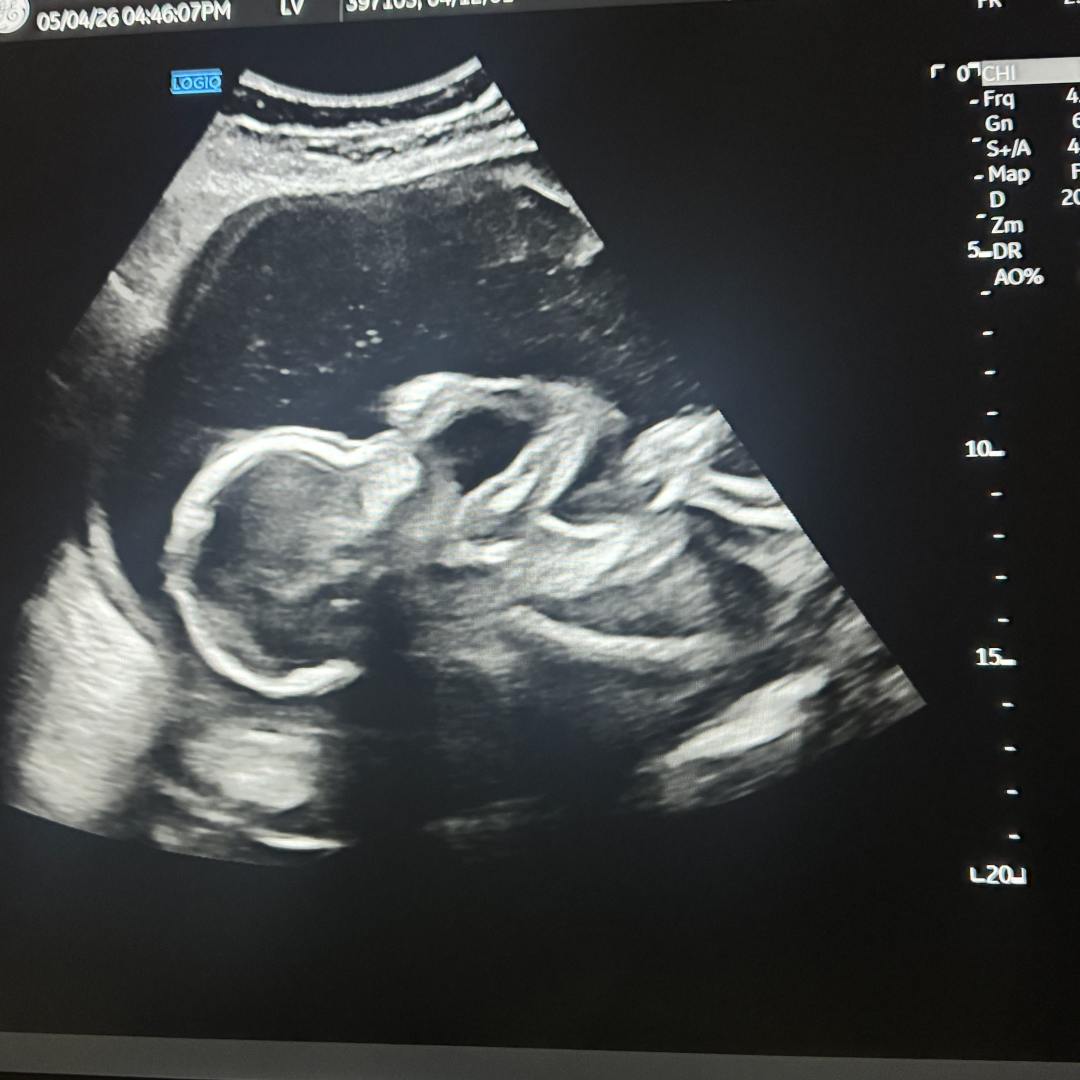 Photo shared by Alessa for their Babylist baby registry.