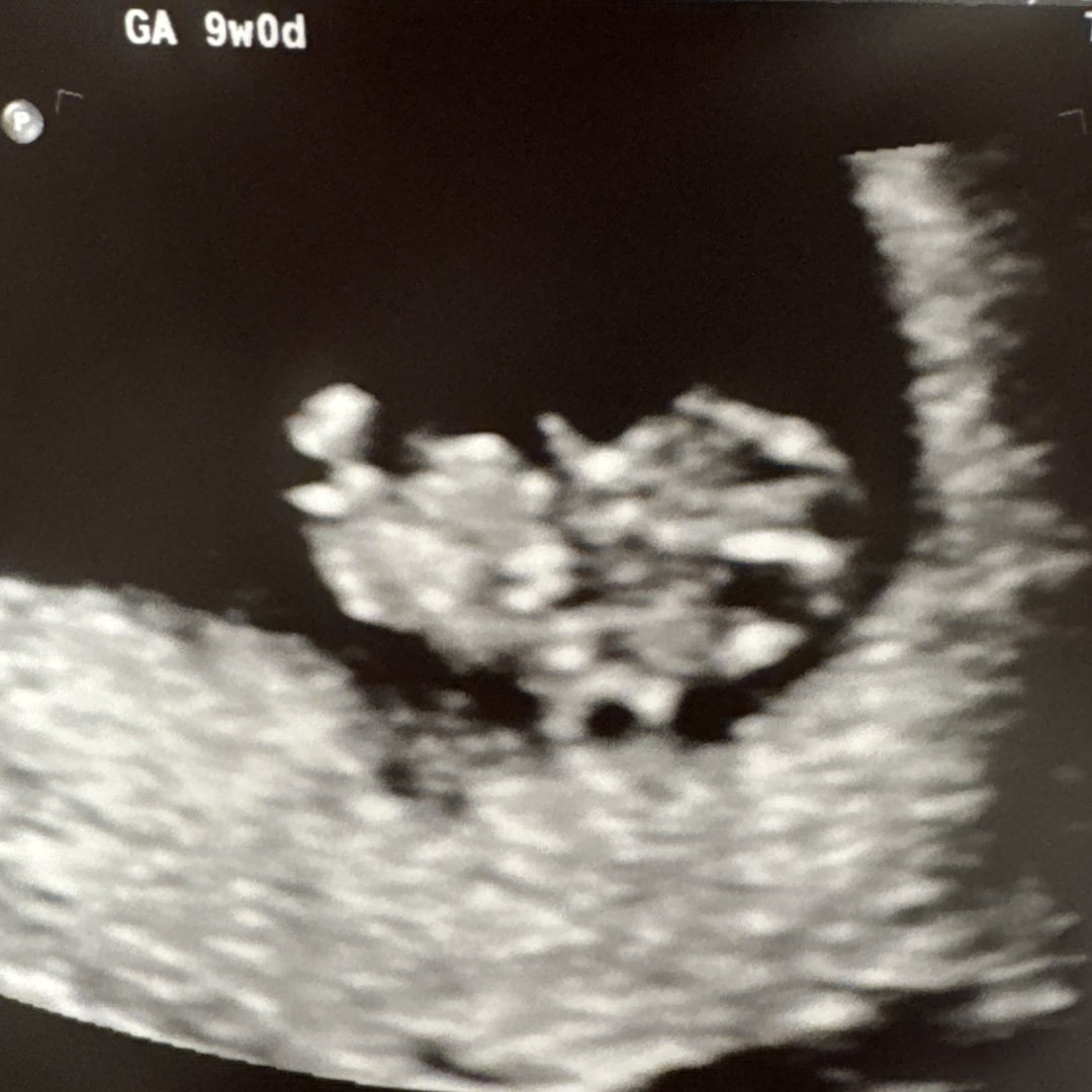 Photo shared by Breanne for their Babylist baby registry.
