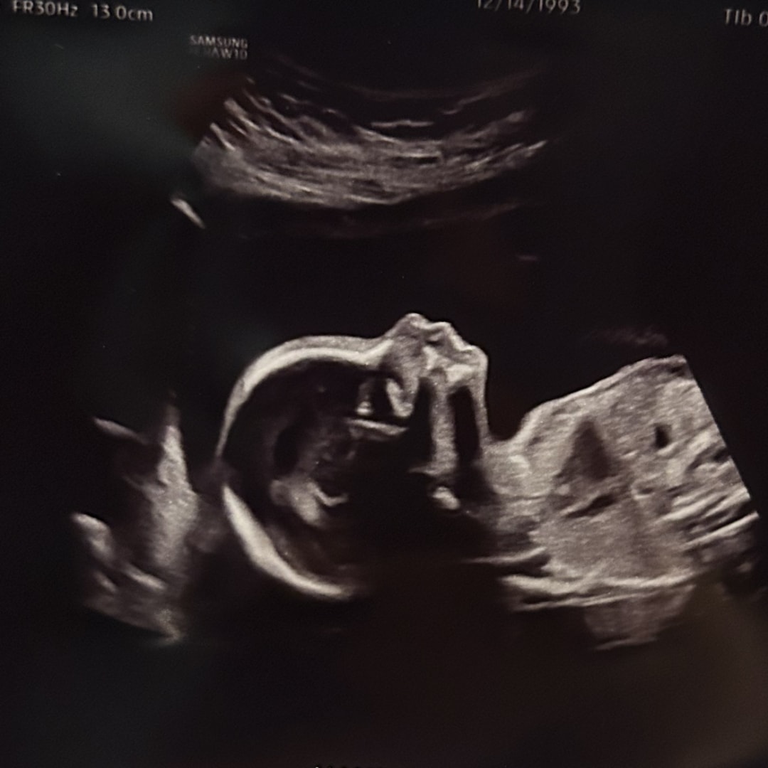 Photo shared by Stephanie for their Babylist baby registry.