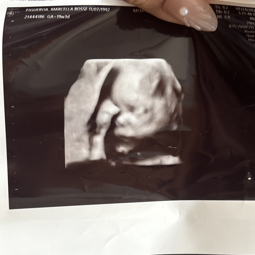 Photo shared by Marcella for their Babylist baby registry.