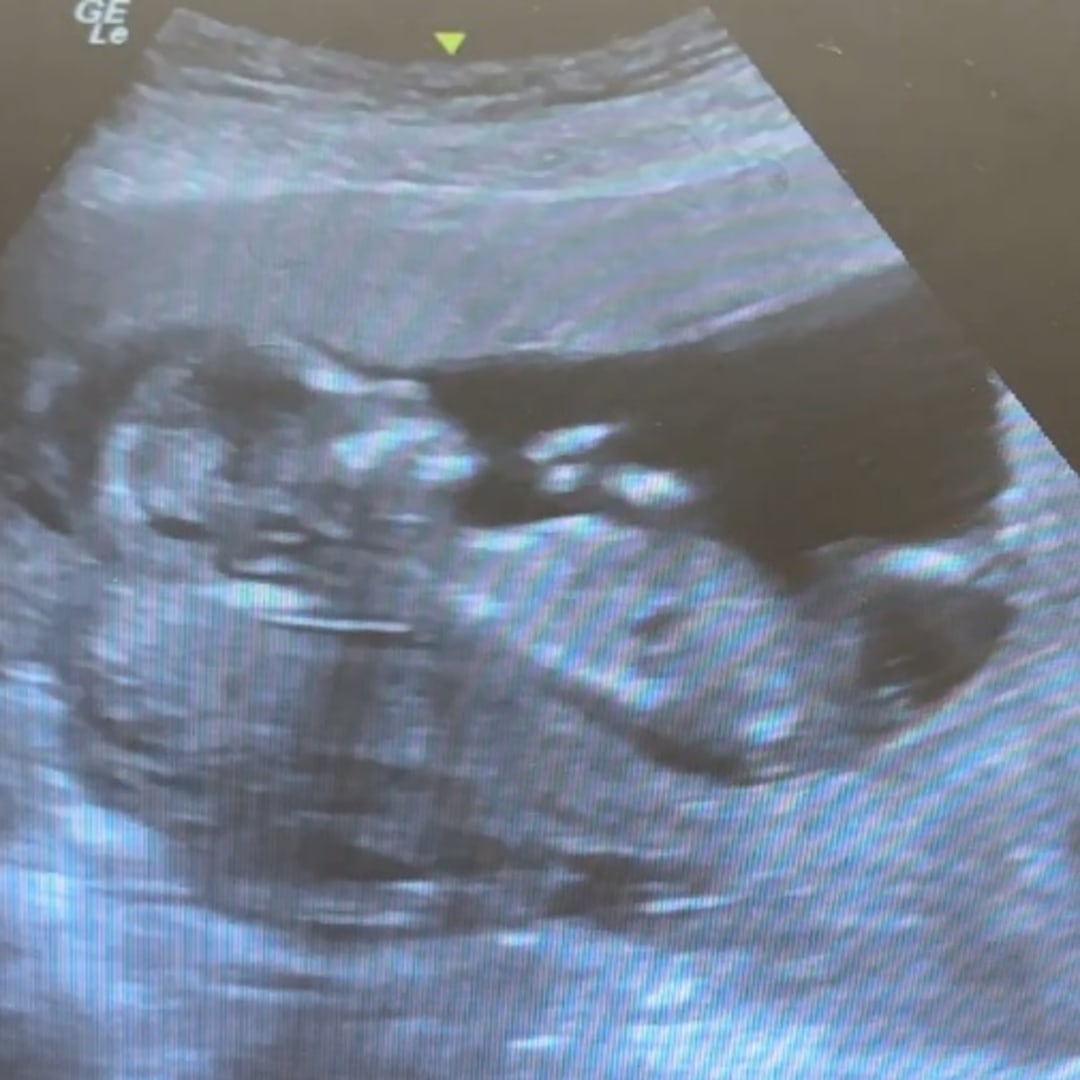 Photo shared by Brigitte for their Babylist baby registry.