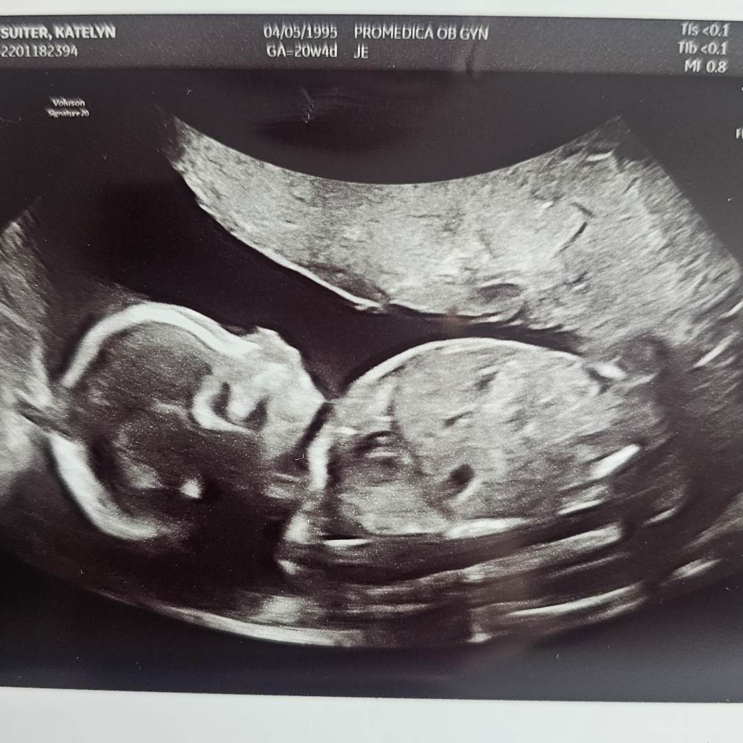 Photo shared by Katie for their Babylist baby registry.