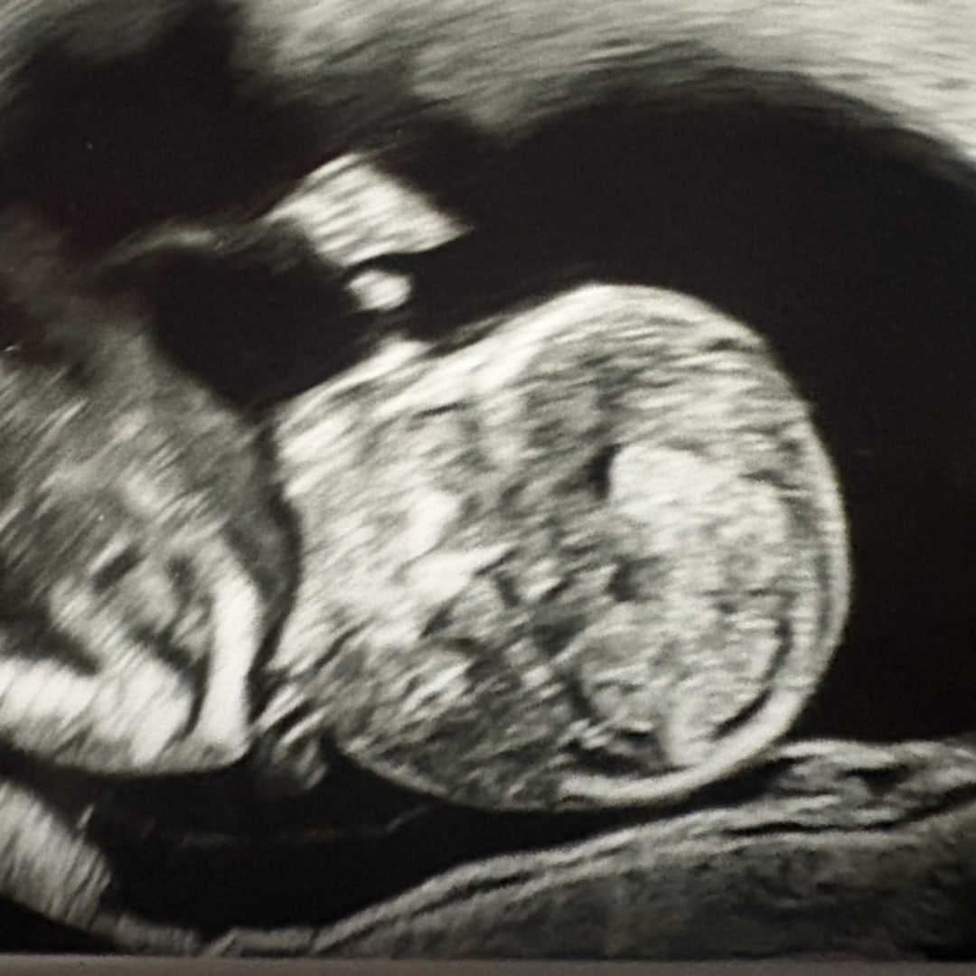 Photo shared by Kate for their Babylist baby registry.