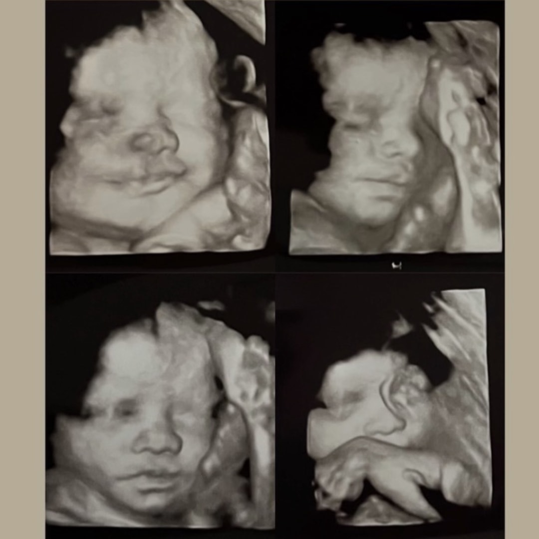 Photo shared by Shelby for their Babylist baby registry.